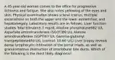 A 45-year-old woman comes to the office for progressive itchiness and fatigue. She also notes yellowing of the eyes and skin. Physical examination shows scleral icterus, multiple excoriations on both the upper and the lower extremities, and hepatomegaly. Laboratory results are as follows: Liver function studies Total bilirubin5.3 mg/dL Alkaline phosphatase982 U/L Aspartate aminotransferase (SGOT)89 U/L Alanine aminotransferase (SGPT)67 U/L Gamma-glutamyl transpeptidase450 U/L (normal: 10-60 U/L) Liver biopsy reveals dense lymphocytic infiltration of the portal triads, as well as granulomatous destruction of interlobular bile ducts. Which of the following is the most likely diagnosis?