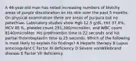 A 46-year-old man has noted increasing numbers of blotchy areas of purple discoloration on his skin over the past 5 months. On physical examination there are areas of purpura but no petechiae. Laboratory studies show Hgb 12.5 g/dL, Hct 37.4%, MCV 85 fL, platelet count 251,300/microliter, and WBC count 8140/microliter. His prothrombin time is 22 seconds and his partial thromboplastin time is 25 seconds. Which of the following is most likely to explain his findings? A Heparin therapy B Lupus anticoagulant C Factor XI deficiency D Severe vonWillebrand disease E Factor VII deficiency