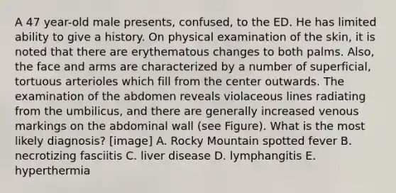 A 47 year-old male presents, confused, to the ED. He has limited ability to give a history. On physical examination of the skin, it is noted that there are erythematous changes to both palms. Also, the face and arms are characterized by a number of superficial, tortuous arterioles which fill from the center outwards. The examination of the abdomen reveals violaceous lines radiating from the umbilicus, and there are generally increased venous markings on the abdominal wall (see Figure). What is the most likely diagnosis? [image] A. Rocky Mountain spotted fever B. necrotizing fasciitis C. liver disease D. lymphangitis E. hyperthermia