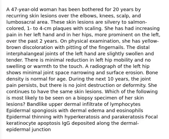 A 47-year-old woman has been bothered for 20 years by recurring skin lesions over the elbows, knees, scalp, and lumbosacral area. These skin lesions are silvery to salmon-colored, 1- to 4-cm plaques with scaling. She has had increasing pain in her left hand and in her hips, more prominent on the left, over the past 2 years. On physical examination, she has yellow-brown discoloration with pitting of the fingernails. The distal interphalangeal joints of the left hand are slightly swollen and tender. There is minimal reduction in left hip mobility and no swelling or warmth to the touch. A radiograph of the left hip shows minimal joint space narrowing and surface erosion. Bone density is normal for age. During the next 10 years, the joint pain persists, but there is no joint destruction or deformity. She continues to have the same skin lesions. Which of the following is most likely to be seen on a biopsy specimen of her skin lesions? Bandlike upper dermal infiltrate of lymphocytes Epidermal spongiosis with dermal edema and eosinophils Epidermal thinning with hyperkeratosis and parakeratosis Focal keratinocyte apoptosis IgG deposited along the dermal-epidermal junction