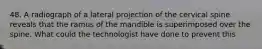 48. A radiograph of a lateral projection of the cervical spine reveals that the ramus of the mandible is superimposed over the spine. What could the technologist have done to prevent this