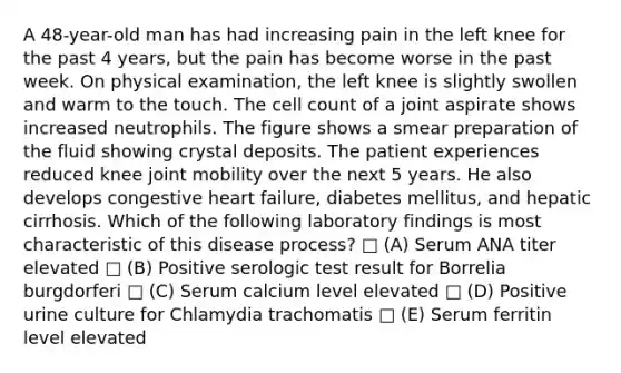 A 48-year-old man has had increasing pain in the left knee for the past 4 years, but the pain has become worse in the past week. On physical examination, the left knee is slightly swollen and warm to the touch. The cell count of a joint aspirate shows increased neutrophils. The figure shows a smear preparation of the fluid showing crystal deposits. The patient experiences reduced knee joint mobility over the next 5 years. He also develops congestive heart failure, diabetes mellitus, and hepatic cirrhosis. Which of the following laboratory findings is most characteristic of this disease process? □ (A) Serum ANA titer elevated □ (B) Positive serologic test result for Borrelia burgdorferi □ (C) Serum calcium level elevated □ (D) Positive urine culture for Chlamydia trachomatis □ (E) Serum ferritin level elevated