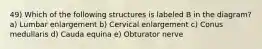 49) Which of the following structures is labeled B in the diagram? a) Lumbar enlargement b) Cervical enlargement c) Conus medullaris d) Cauda equina e) Obturator nerve