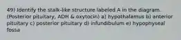 49) Identify the stalk-like structure labeled A in the diagram. (Posterior pituitary, ADH & oxytocin) a) hypothalamus b) anterior pituitary c) posterior pituitary d) infundibulum e) hypophyseal fossa