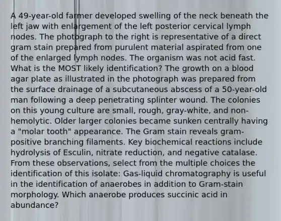 A 49-year-old farmer developed swelling of the neck beneath the left jaw with enlargement of the left posterior cervical lymph nodes. The photograph to the right is representative of a direct gram stain prepared from purulent material aspirated from one of the enlarged lymph nodes. The organism was not acid fast. What is the MOST likely identification? The growth on a blood agar plate as illustrated in the photograph was prepared from the surface drainage of a subcutaneous abscess of a 50-year-old man following a deep penetrating splinter wound. The colonies on this young culture are small, rough, gray-white, and non-hemolytic. Older larger colonies became sunken centrally having a "molar tooth" appearance. The Gram stain reveals gram-positive branching filaments. Key biochemical reactions include hydrolysis of Esculin, nitrate reduction, and negative catalase. From these observations, select from the multiple choices the identification of this isolate: Gas-liquid chromatography is useful in the identification of anaerobes in addition to Gram-stain morphology. Which anaerobe produces succinic acid in abundance?