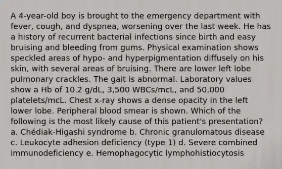 A 4-year-old boy is brought to the emergency department with fever, cough, and dyspnea, worsening over the last week. He has a history of recurrent bacterial infections since birth and easy bruising and bleeding from gums. Physical examination shows speckled areas of hypo- and hyperpigmentation diffusely on his skin, with several areas of bruising. There are lower left lobe pulmonary crackles. The gait is abnormal. Laboratory values show a Hb of 10.2 g/dL, 3,500 WBCs/mcL, and 50,000 platelets/mcL. Chest x-ray shows a dense opacity in the left lower lobe. Peripheral blood smear is shown. Which of the following is the most likely cause of this patient's presentation? a. Chédiak-Higashi syndrome b. Chronic granulomatous disease c. Leukocyte adhesion deficiency (type 1) d. Severe combined immunodeficiency e. Hemophagocytic lymphohistiocytosis