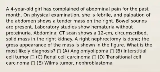 A 4-year-old girl has complained of abdominal pain for the past month. On physical examination, she is febrile, and palpation of the abdomen shows a tender mass on the right. Bowel sounds are present. Laboratory studies show hematuria without proteinuria. Abdominal CT scan shows a 12-cm, circumscribed, solid mass in the right kidney. A right nephrectomy is done; the gross appearance of the mass is shown in the figure. What is the most likely diagnosis? □ (A) Angiomyolipoma □ (B) Interstitial cell tumor □ (C) Renal cell carcinoma □ (D) Transitional cell carcinoma □ (E) Wilms tumor, nephroblastoma