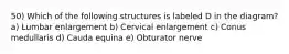 50) Which of the following structures is labeled D in the diagram? a) Lumbar enlargement b) Cervical enlargement c) Conus medullaris d) Cauda equina e) Obturator nerve