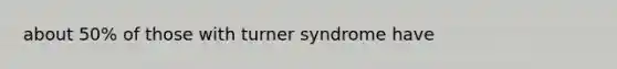 about 50% of those with turner syndrome have