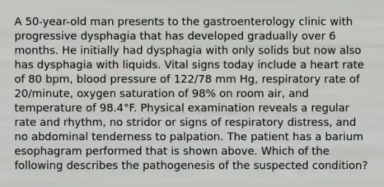 A 50-year-old man presents to the gastroenterology clinic with progressive dysphagia that has developed gradually over 6 months. He initially had dysphagia with only solids but now also has dysphagia with liquids. Vital signs today include a heart rate of 80 bpm, blood pressure of 122/78 mm Hg, respiratory rate of 20/minute, oxygen saturation of 98% on room air, and temperature of 98.4°F. Physical examination reveals a regular rate and rhythm, no stridor or signs of respiratory distress, and no abdominal tenderness to palpation. The patient has a barium esophagram performed that is shown above. Which of the following describes the pathogenesis of the suspected condition?