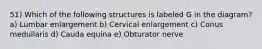 51) Which of the following structures is labeled G in the diagram? a) Lumbar enlargement b) Cervical enlargement c) Conus medullaris d) Cauda equina e) Obturator nerve