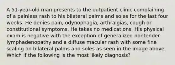 A 51-year-old man presents to the outpatient clinic complaining of a painless rash to his bilateral palms and soles for the last four weeks. He denies pain, odynophagia, arthralgias, cough or constitutional symptoms. He takes no medications. His physical exam is negative with the exception of generalized nontender lymphadenopathy and a diffuse macular rash with some fine scaling on bilateral palms and soles as seen in the image above. Which if the following is the most likely diagnosis?