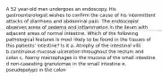 A 52 year-old man undergoes an endoscopy. His gastroenterologist wishes to confirm the cause of his intermittent attacks of diarrhoea and abdominal pain. The endoscopist observes areas of oedema and inflammation in the ileum with adjacent areas of normal intestine. Which of the following pathological features is most likely to be found in the tissues of this patients' intestine? Is it a. Atrophy of the intestinal villi b.continuous mucosal ulceration throughout the rectum and colon c. foamy macrophages in the mucosa of the small intestine d non-caseating granulomas in the small intestine e. pseudopolyps in the colon