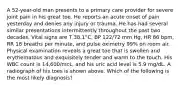 A 52-year-old man presents to a primary care provider for severe joint pain in his great toe. He reports an acute onset of pain yesterday and denies any injury or trauma. He has had several similar presentations intermittently throughout the past two decades. Vital signs are T 38.1°C, BP 122/72 mm Hg, HR 86 bpm, RR 18 breaths per minute, and pulse oximetry 99% on room air. Physical examination reveals a great toe that is swollen and erythematous and exquisitely tender and warm to the touch. His WBC count is 14,600/mcL, and his uric acid level is 5.9 mg/dL. A radiograph of his toes is shown above. Which of the following is the most likely diagnosis?