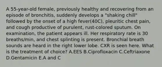 A 55-year-old female, previously healthy and recovering from an episode of bronchitis, suddenly develops a "shaking chill" followed by the onset of a high fever(40C), pleuritic chest pain, and cough productive of purulent, rust-colored sputum. On examination, the patient appears ill. Her respiratory rate is 30 breaths/min, and chest splinting is present. Bronchial breath sounds are heard in the right lower lobe. CXR is seen here. What is the treatment of choice? A.EES B.Ciprofloxacin C.Ceftriaxone D.Gentamicin E.A and C