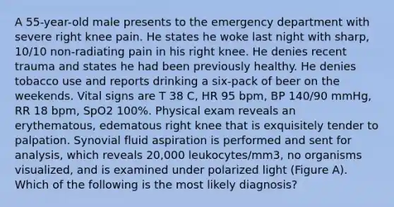 A 55-year-old male presents to the emergency department with severe right knee pain. He states he woke last night with sharp, 10/10 non-radiating pain in his right knee. He denies recent trauma and states he had been previously healthy. He denies tobacco use and reports drinking a six-pack of beer on the weekends. Vital signs are T 38 C, HR 95 bpm, BP 140/90 mmHg, RR 18 bpm, SpO2 100%. Physical exam reveals an erythematous, edematous right knee that is exquisitely tender to palpation. Synovial fluid aspiration is performed and sent for analysis, which reveals 20,000 leukocytes/mm3, no organisms visualized, and is examined under polarized light (Figure A). Which of the following is the most likely diagnosis?