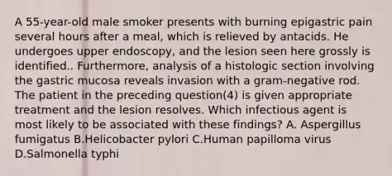 A 55-year-old male smoker presents with burning epigastric pain several hours after a meal, which is relieved by antacids. He undergoes upper endoscopy, and the lesion seen here grossly is identified.. Furthermore, analysis of a histologic section involving the gastric mucosa reveals invasion with a gram-negative rod. The patient in the preceding question(4) is given appropriate treatment and the lesion resolves. Which infectious agent is most likely to be associated with these findings? A. Aspergillus fumigatus B.Helicobacter pylori C.Human papilloma virus D.Salmonella typhi