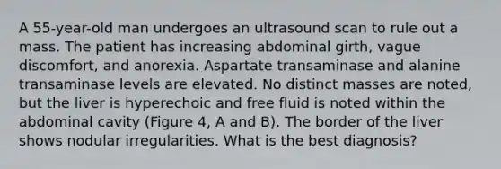 A 55-year-old man undergoes an ultrasound scan to rule out a mass. The patient has increasing abdominal girth, vague discomfort, and anorexia. Aspartate transaminase and alanine transaminase levels are elevated. No distinct masses are noted, but the liver is hyperechoic and free fluid is noted within the abdominal cavity (Figure 4, A and B). The border of the liver shows nodular irregularities. What is the best diagnosis?