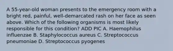 A 55-year-old woman presents to the emergency room with a bright red, painful, well-demarcated rash on her face as seen above. Which of the following organisms is most likely responsible for this condition? ADD PIC A. Haemophilus influenzae B. Staphylococcus aureus C. Streptococcus pneumoniae D. Streptococcus pyogenes