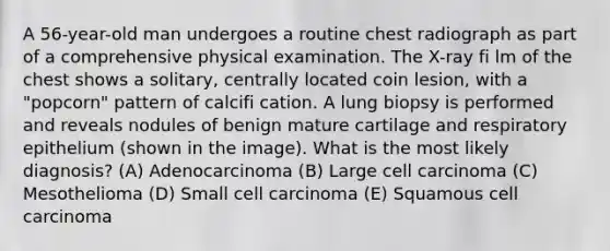 A 56-year-old man undergoes a routine chest radiograph as part of a comprehensive physical examination. The X-ray fi lm of the chest shows a solitary, centrally located coin lesion, with a "popcorn" pattern of calcifi cation. A lung biopsy is performed and reveals nodules of benign mature cartilage and respiratory epithelium (shown in the image). What is the most likely diagnosis? (A) Adenocarcinoma (B) Large cell carcinoma (C) Mesothelioma (D) Small cell carcinoma (E) Squamous cell carcinoma