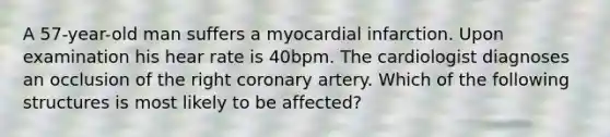 A 57-year-old man suffers a myocardial infarction. Upon examination his hear rate is 40bpm. The cardiologist diagnoses an occlusion of the right coronary artery. Which of the following structures is most likely to be affected?