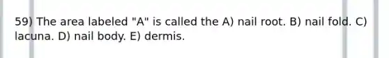 59) The area labeled "A" is called the A) nail root. B) nail fold. C) lacuna. D) nail body. E) dermis.