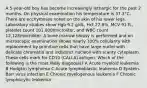 A 5-year-old boy has become increasingly lethargic for the past 2 months. On physical examination his temperature is 37.3°C. There are ecchymoses noted on the skin of his lower legs. Laboratory studies show Hgb 9.2 g/dL, Hct 27.8%, MCV 91 fL, platelet count 101,000/microliter, and WBC count 12,128/microliter. A bone marrow biopsy is performed and on microscopic examination shows nearly 100% cellularity with replacement by primitive cells that have large nuclei with delicate chromatin and indistinct nucleoli with scanty cytoplasm. These cells mark for CD10 (CALLA) antigen. Which of the following is the most likely diagnosis? A Acute myeloid leukemia B Hodgkin lymphoma C Acute lymphoblastic leukemia D Epstein-Barr virus infection E Chronic myelogenous leukemia F Chronic lymphocytic leukemia