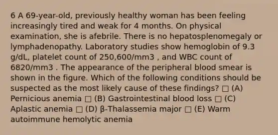 6 A 69-year-old, previously healthy woman has been feeling increasingly tired and weak for 4 months. On physical examination, she is afebrile. There is no hepatosplenomegaly or lymphadenopathy. Laboratory studies show hemoglobin of 9.3 g/dL, platelet count of 250,600/mm3 , and WBC count of 6820/mm3 . The appearance of the peripheral blood smear is shown in the figure. Which of the following conditions should be suspected as the most likely cause of these findings? □ (A) Pernicious anemia □ (B) Gastrointestinal blood loss □ (C) Aplastic anemia □ (D) β-Thalassemia major □ (E) Warm autoimmune hemolytic anemia