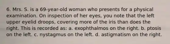 6. Mrs. S. is a 69-year-old woman who presents for a physical examination. On inspection of her eyes, you note that the left upper eyelid droops, covering more of the iris than does the right. This is recorded as: a. exophthalmos on the right. b. ptosis on the left. c. nystagmus on the left. d. astigmatism on the right.