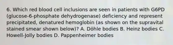 6. Which red blood cell inclusions are seen in patients with G6PD (glucose-6-phosphate dehydrogenase) deficiency and represent precipitated, denatured hemoglobin (as shown on the supravital stained smear shown below)? A. Döhle bodies B. Heinz bodies C. Howell-Jolly bodies D. Pappenheimer bodies