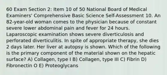 60 Exam Section 2: Item 10 of 50 National Board of Medical Examiners' Comprehensive Basic Science Self-Assessment 10. An 82-year-old woman comes to the physician because of constant severe lower abdominal pain and fever for 24 hours. Laparoscopic examination shows severe diverticulosis and perforated diverticulitis. In spite of appropriate therapy, she dies 2 days later. Her liver at autopsy is shown. Which of the following is the primary component of the material shown on the hepatic surface? A) Collagen, type I B) Collagen, type III C) Fibrin D) Fibronectin O E) Proteoglycans