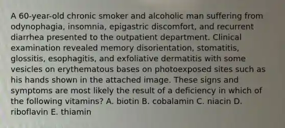 A 60-year-old chronic smoker and alcoholic man suffering from odynophagia, insomnia, epigastric discomfort, and recurrent diarrhea presented to the outpatient department. Clinical examination revealed memory disorientation, stomatitis, glossitis, esophagitis, and exfoliative dermatitis with some vesicles on erythematous bases on photoexposed sites such as his hands shown in the attached image. These signs and symptoms are most likely the result of a deficiency in which of the following vitamins? A. biotin B. cobalamin C. niacin D. riboflavin E. thiamin