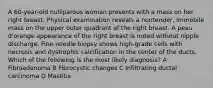 A 60-year-old nulliparous woman presents with a mass on her right breast. Physical examination reveals a nontender, immobile mass on the upper outer quadrant of the right breast. A peau d'orange appearance of the right breast is noted without nipple discharge. Fine-needle biopsy shows high-grade cells with necrosis and dystrophic calcification in the center of the ducts. Which of the following is the most likely diagnosis? A Fibroadenoma B Fibrocystic changes C Infiltrating ductal carcinoma D Mastitis