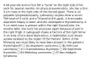 A 60-year-old woman has felt a "lump" on the right side of her neck for several months. On physical examination, she has a firm 3-cm mass in the right lobe of the thyroid gland. There is no palpable lymphadenopathy. Laboratory studies show a serum TSH level of 3 mU/L and a T4 level of 8.8 μg/dL. A fine-needle aspiration biopsy is done, and she undergoes a thyroidectomy. A 3-cm solid mass is present within the right thyroid lobe. Six months later, she visits her physician again because of pain in the right thigh. A radiograph shows a fracture of the right femur in an area of lytic bone destruction. A radioiodine scan shows uptake localized to the region of the fracture. Which of the following was most likely to have been present in the patient's thyroid gland? □ (A) Anaplastic carcinoma □ (B) Follicular carcinoma □ (C) Granulomatous thyroiditis □ (D) Hashimoto thyroiditis □ (E) Medullary carcinoma □ (F) Non-Hodgkin lymphoma