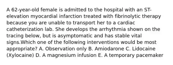 A 62-year-old female is admitted to the hospital with an ST-elevation myocardial infarction treated with fibrinolytic therapy because you are unable to transport her to a cardiac catheterization lab. She develops the arrhythmia shown on the tracing below, but is asymptomatic and has stable vital signs.Which one of the following interventions would be most appropriate? A. Observation only B. Amiodarone C. Lidocaine (Xylocaine) D. A magnesium infusion E. A temporary pacemaker