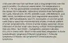 A 62-year-old man has had fever and a 4-kg weight loss over the past 6 months. On physical examination, his temperature is 38.6° C. He has generalized nontender lymphadenopathy, and the spleen tip is palpable. Laboratory studies show hemoglobin, 10.1 g/dL; hematocrit, 30.3%; platelet count, 140,000/mm3; and WBC count, 24,500/mm3 with 10% segmented neutrophils, 1% bands, 86% lymphocytes, and 3% monocytes. A cervical lymph node biopsy specimen microscopically shows a nodular pattern of small lymphoid cells. A bone marrow biopsy specimen shows infiltrates of similar small cells having surface immunoglobulins that are CD5+, but CD10−. Cytogenetic analysis indicates t(11;14) in these cells. What is the most likely diagnosis? A Acute lymphoblastic lymphoma B Burkitt lymphoma C Follicular lymphoma D Mantle cell lymphoma E Small lymphocytic lymphoma