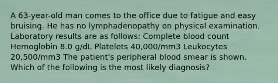 A 63-year-old man comes to the office due to fatigue and easy bruising. He has no lymphadenopathy on physical examination. Laboratory results are as follows: Complete blood count Hemoglobin 8.0 g/dL Platelets 40,000/mm3 Leukocytes 20,500/mm3 The patient's peripheral blood smear is shown. Which of the following is the most likely diagnosis?