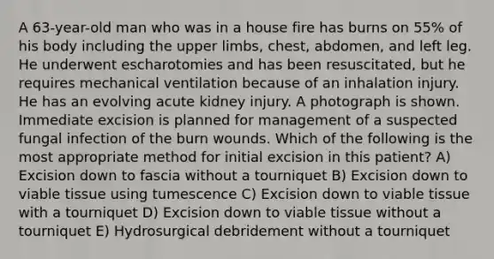 A 63-year-old man who was in a house fire has burns on 55% of his body including the upper limbs, chest, abdomen, and left leg. He underwent escharotomies and has been resuscitated, but he requires mechanical ventilation because of an inhalation injury. He has an evolving acute kidney injury. A photograph is shown. Immediate excision is planned for management of a suspected fungal infection of the burn wounds. Which of the following is the most appropriate method for initial excision in this patient? A) Excision down to fascia without a tourniquet B) Excision down to viable tissue using tumescence C) Excision down to viable tissue with a tourniquet D) Excision down to viable tissue without a tourniquet E) Hydrosurgical debridement without a tourniquet