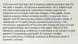 A 63-year-old man has had increasing malaise and back pain for the past 4 months. On physical examination, he is afebrile and has mild muscle wasting. Laboratory studies show serum creatinine of 4.5 mg/dL and urea nitrogen of 44 mg/dL. Urine dipstick analysis shows no blood, protein, or glucose, but a specific test for Bence Jones proteins yields a positive result. A radiograph of his spine shows rounded lucent lesions. The microscopic appearance of his liver with Congo red stain (A) and with polarized light (B) is shown in the figure. Which of the following underlying conditions is most likely to be present in this patient? A Ankylosing spondylitis B Common variable immunodeficiency C Multiple myeloma D Rheumatic fever E Systemic sclerosis