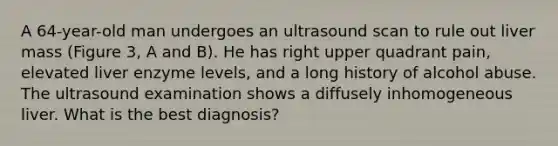 A 64-year-old man undergoes an ultrasound scan to rule out liver mass (Figure 3, A and B). He has right upper quadrant pain, elevated liver enzyme levels, and a long history of alcohol abuse. The ultrasound examination shows a diffusely inhomogeneous liver. What is the best diagnosis?