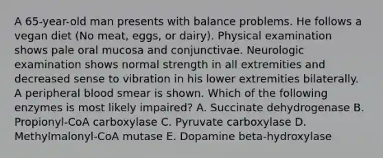 A 65-year-old man presents with balance problems. He follows a vegan diet (No meat, eggs, or dairy). Physical examination shows pale oral mucosa and conjunctivae. Neurologic examination shows normal strength in all extremities and decreased sense to vibration in his lower extremities bilaterally. A peripheral blood smear is shown. Which of the following enzymes is most likely impaired? A. Succinate dehydrogenase B. Propionyl-CoA carboxylase C. Pyruvate carboxylase D. Methylmalonyl-CoA mutase E. Dopamine beta-hydroxylase