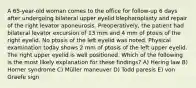 A 65-year-old woman comes to the office for follow-up 6 days after undergoing bilateral upper eyelid blepharoplasty and repair of the right levator aponeurosis. Preoperatively, the patient had bilateral levator excursion of 13 mm and 4 mm of ptosis of the right eyelid. No ptosis of the left eyelid was noted. Physical examination today shows 2 mm of ptosis of the left upper eyelid. The right upper eyelid is well positioned. Which of the following is the most likely explanation for these findings? A) Hering law B) Horner syndrome C) Müller maneuver D) Todd paresis E) von Graefe sign