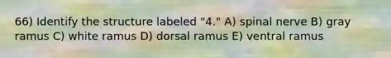 66) Identify the structure labeled "4." A) spinal nerve B) gray ramus C) white ramus D) dorsal ramus E) ventral ramus