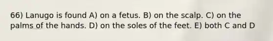 66) Lanugo is found A) on a fetus. B) on the scalp. C) on the palms of the hands. D) on the soles of the feet. E) both C and D