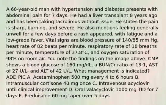 A 68-year-old man with hypertension and diabetes presents with abdominal pain for 7 days. He had a liver transplant 8 years ago and has been taking tacrolimus without issue. He states the pain is sharp, burning, and severe. He also mentions feeling generally unwell for a few days before a rash appeared, with fatigue and a low-grade fever. Vital signs are blood pressure of 140/85 mm Hg, heart rate of 82 beats per minute, respiratory rate of 18 breaths per minute, temperature of 37.8°C, and oxygen saturation of 98% on room air. You note the findings on the image above. CMP shows a blood glucose of 160 mg/dL, a BUN/Cr ratio of 13:1, AST of 27 U/L, and ALT of 42 U/L. What management is indicated? ADD PIC A. Acetaminophen 500 mg every 4 to 6 hours B. Intramuscular cortisone 40 mg once C. Intravenous acyclovir until clinical improvement D. Oral valacyclovir 1000 mg TID for 7 days E. Prednisone 60 mg taper over 5 days