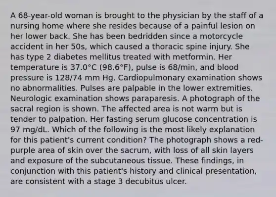 A 68-year-old woman is brought to the physician by the staff of a nursing home where she resides because of a painful lesion on her lower back. She has been bedridden since a motorcycle accident in her 50s, which caused a thoracic spine injury. She has type 2 diabetes mellitus treated with metformin. Her temperature is 37.0°C (98.6°F), pulse is 68/min, and blood pressure is 128/74 mm Hg. Cardiopulmonary examination shows no abnormalities. Pulses are palpable in the lower extremities. Neurologic examination shows paraparesis. A photograph of the sacral region is shown. The affected area is not warm but is tender to palpation. Her fasting serum glucose concentration is 97 mg/dL. Which of the following is the most likely explanation for this patient's current condition? The photograph shows a red-purple area of skin over the sacrum, with loss of all skin layers and exposure of the subcutaneous tissue. These findings, in conjunction with this patient's history and clinical presentation, are consistent with a stage 3 decubitus ulcer.