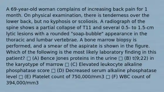 A 69-year-old woman complains of increasing back pain for 1 month. On physical examination, there is tenderness over the lower back, but no kyphosis or scoliosis. A radiograph of the spine shows a partial collapse of T11 and several 0.5- to 1.5-cm lytic lesions with a rounded "soap-bubble" appearance in the thoracic and lumbar vertebrae. A bone marrow biopsy is performed, and a smear of the aspirate is shown in the figure. Which of the following is the most likely laboratory finding in this patient? □ (A) Bence Jones proteins in the urine □ (B) t(9;22) in the karyotype of marrow □ (C) Elevated leukocyte alkaline phosphatase score □ (D) Decreased serum alkaline phosphatase level □ (E) Platelet count of 750,000/mm3 □ (F) WBC count of 394,000/mm3