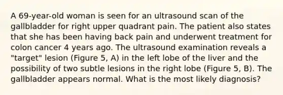 A 69-year-old woman is seen for an ultrasound scan of the gallbladder for right upper quadrant pain. The patient also states that she has been having back pain and underwent treatment for colon cancer 4 years ago. The ultrasound examination reveals a "target" lesion (Figure 5, A) in the left lobe of the liver and the possibility of two subtle lesions in the right lobe (Figure 5, B). The gallbladder appears normal. What is the most likely diagnosis?