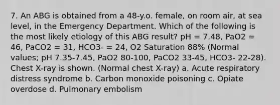 7. An ABG is obtained from a 48-y.o. female, on room air, at sea level, in the Emergency Department. Which of the following is the most likely etiology of this ABG result? pH = 7.48, PaO2 = 46, PaCO2 = 31, HCO3- = 24, O2 Saturation 88% (Normal values; pH 7.35-7.45, PaO2 80-100, PaCO2 33-45, HCO3- 22-28). Chest X-ray is shown. (Normal chest X-ray) a. Acute respiratory distress syndrome b. Carbon monoxide poisoning c. Opiate overdose d. Pulmonary embolism