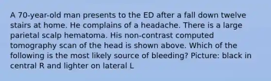 A 70-year-old man presents to the ED after a fall down twelve stairs at home. He complains of a headache. There is a large parietal scalp hematoma. His non-contrast computed tomography scan of the head is shown above. Which of the following is the most likely source of bleeding? Picture: black in central R and lighter on lateral L